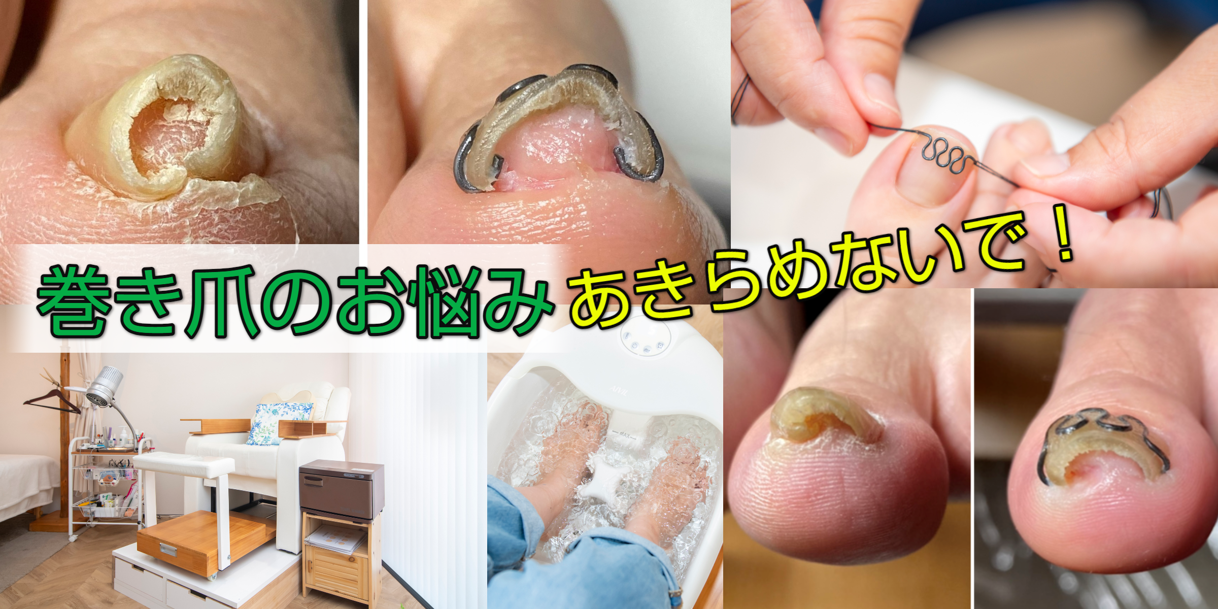プチ矯正のススメ プチ矯正のススメ| 歯科総合出版社 デンタルダイヤモンド社